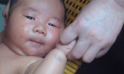 患有婴儿湿疹要怎么护理